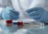 Ebola test tube on lab table with gloved researcher in background