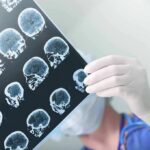 Doctor holding brain MRI scans