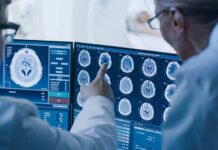Doctors reviewing brain MRI scans on multiple monitors