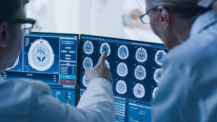 Doctors reviewing brain MRI scans on multiple monitors