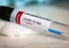 COVID-19 test tube labeled positive on gauze