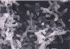 Brain-Eating Amoeba’s Sneaky Shortcut Exposed Bacteria under scanning electron microscope