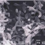 Bacteria under scanning electron microscope