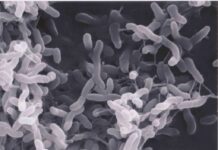 Brain-Eating Amoeba’s Sneaky Shortcut Exposed Bacteria under scanning electron microscope