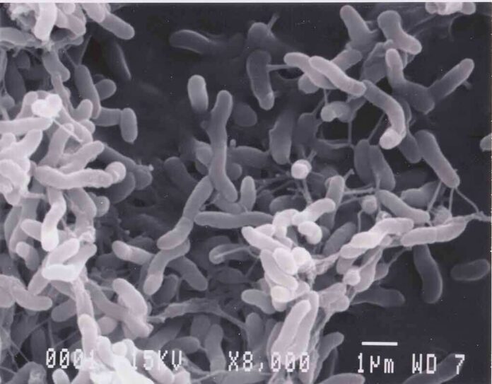 shutterstock_1868642461 Bacteria under scanning electron microscope